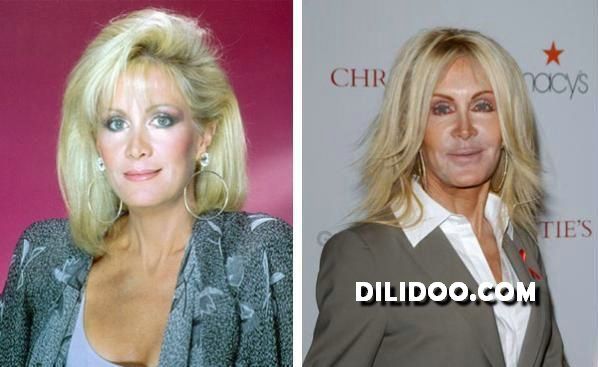 When plastic surgery fails (38 pics)