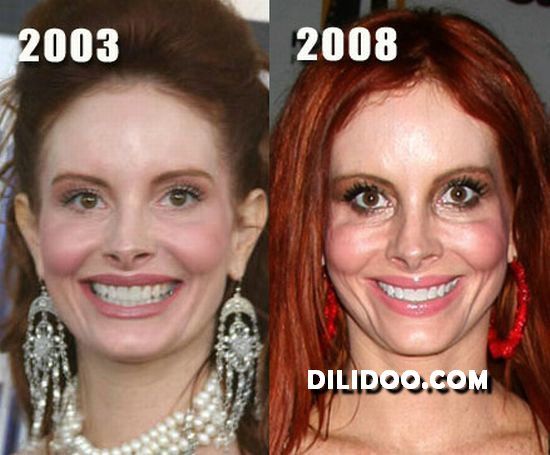 When plastic surgery fails (38 pics)