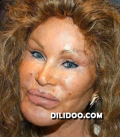 When plastic surgery fails (38 pics)