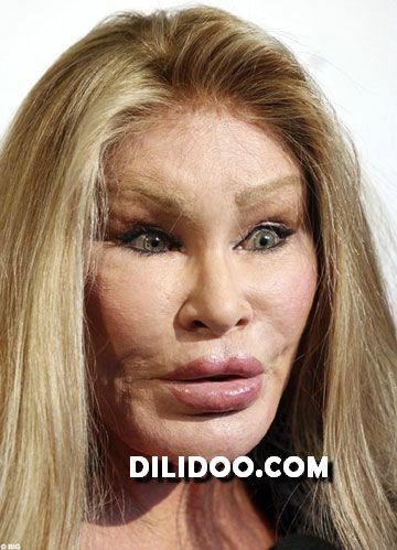 When plastic surgery fails (38 pics)
