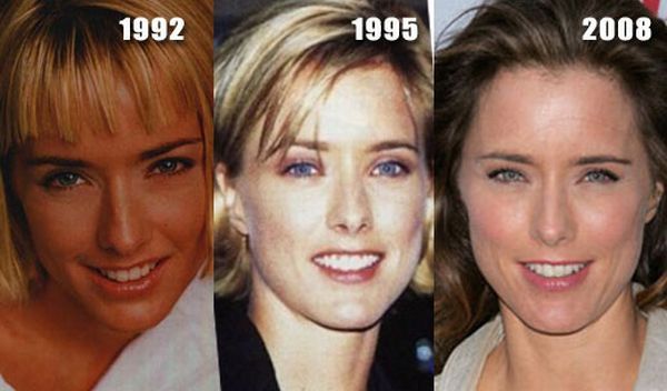 When plastic surgery fails (38 pics)