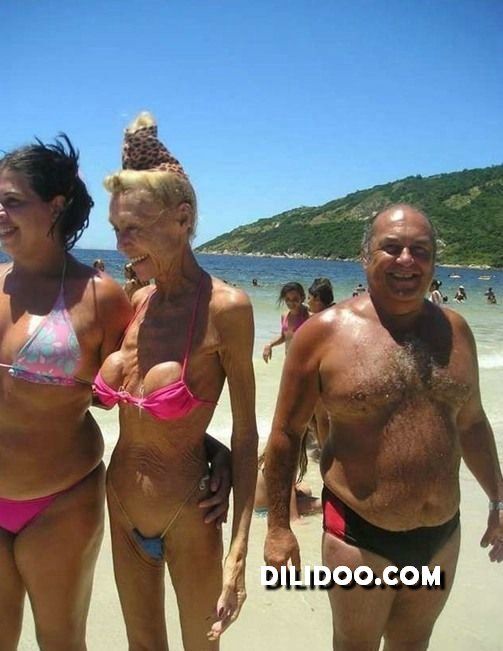When plastic surgery fails (38 pics)