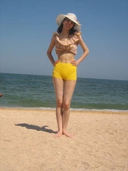 Girl with funny teeth (10 pics) Girl with funny teeth (10 pics)