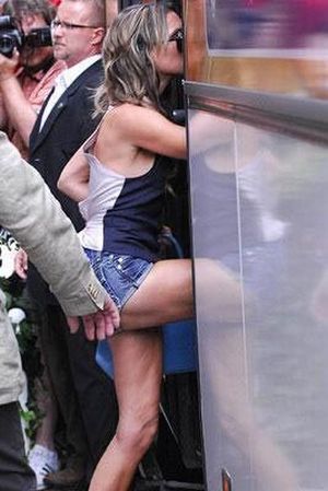 Celebrities and Their Imperfections! (58 pics)