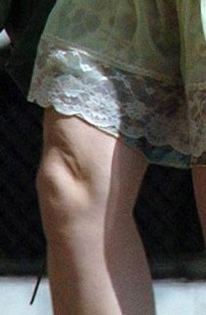 Celebrities and Their Imperfections! (58 pics)