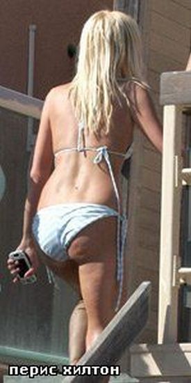 Celebrities and Their Imperfections! (58 pics)