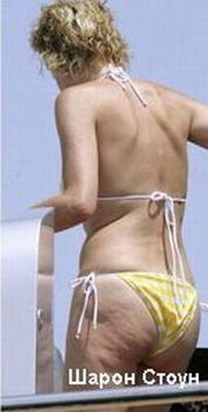 Celebrities and Their Imperfections! (58 pics)