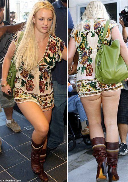 Celebrities and Their Imperfections! (58 pics)