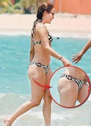 Celebrities and Their Imperfections! (58 pics)