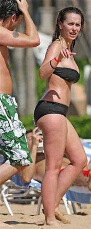 Celebrities and Their Imperfections! (58 pics)