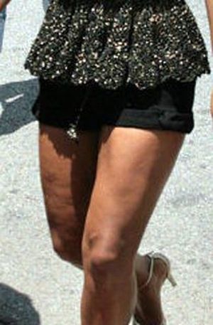 Celebrities and Their Imperfections! (58 pics)