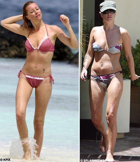 Celebrities and Their Imperfections! (58 pics)