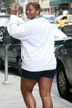 Celebrities and Their Imperfections! (58 pics)