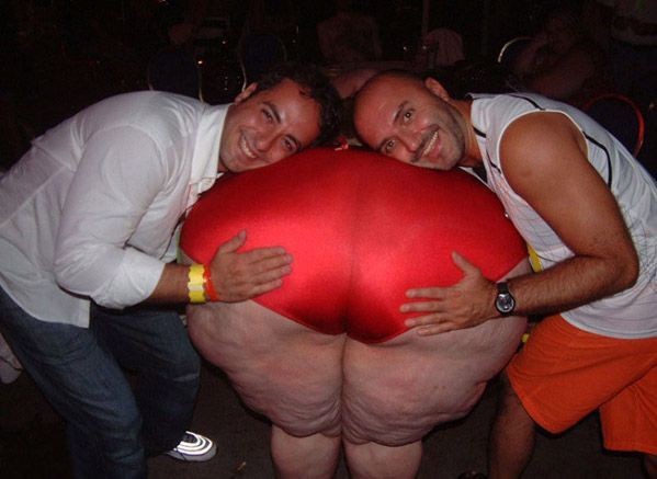 Celebrities and Their Imperfections! (58 pics)