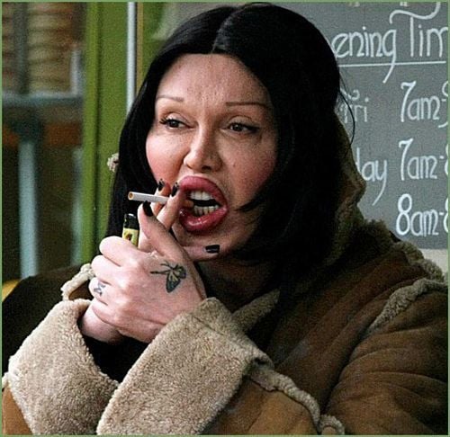 Incredible Transformation of Pete Burns (11 pics)