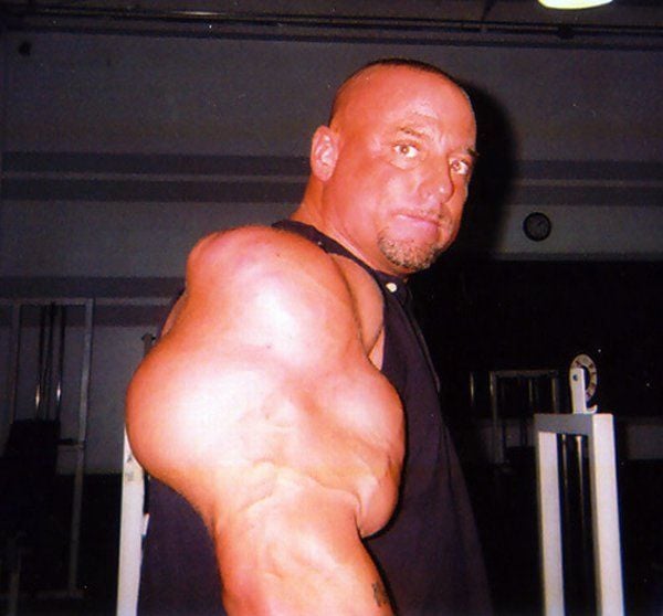 When Synthol Utilisation Goes Wrong! (53 pics)