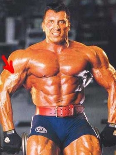 When Synthol Utilisation Goes Wrong! (53 pics)