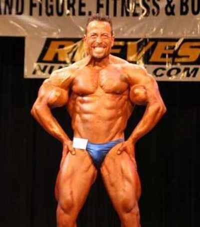 When Synthol Utilisation Goes Wrong! (53 pics)