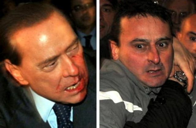 Berlusconi Gets a Broken Nose and Loses Two Teeth during the Assault (7 pics+1 video)