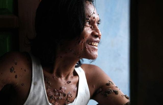 Have You Ever Seen a Tree Man? (19 pics)