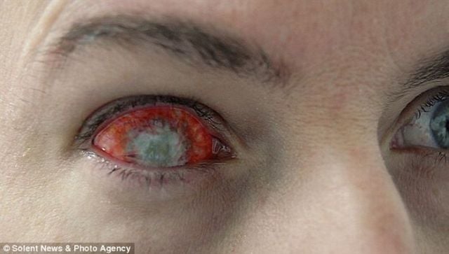 Freaky Contact Lenses (7 pics)