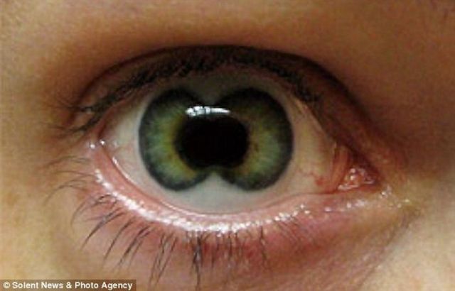 Freaky Contact Lenses (7 pics)