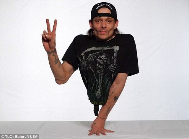 The Man with Half a Body! (33 pics)