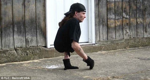 The Man with Half a Body! (33 pics)