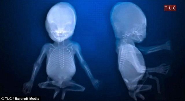 The Man with Half a Body! (33 pics)