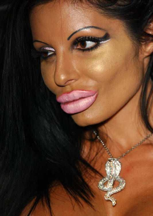 &ldquo;Monster&rdquo; Smile (16 pics)