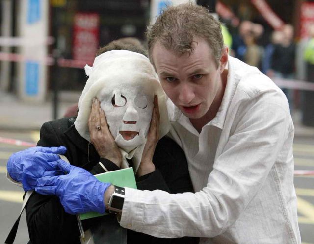 Incredible Healing after a Bomb Explosion (15 pics)