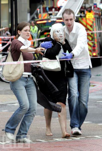 Incredible Healing after a Bomb Explosion (15 pics)