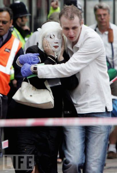 Incredible Healing after a Bomb Explosion (15 pics)