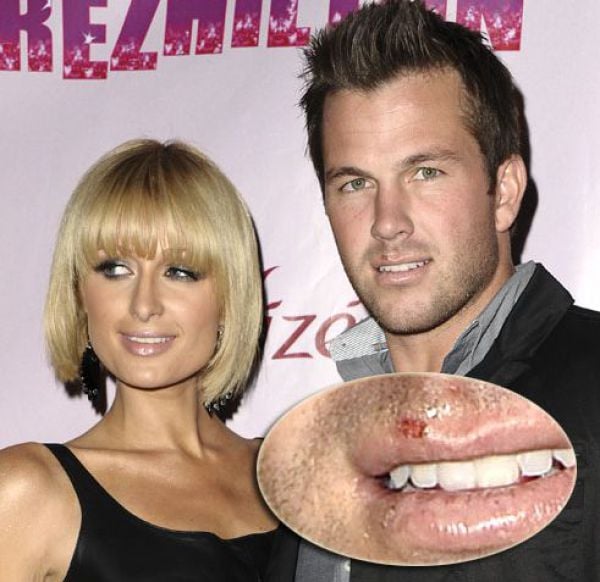 Celebrities Aren’t Perfect (31 pics) Celebrities Aren’t Perfect (31 pics)