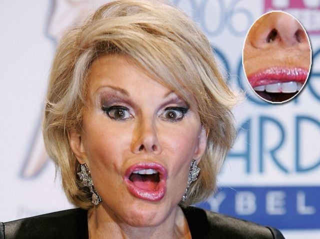 Celebrities Aren’t Perfect (31 pics) Celebrities Aren’t Perfect (31 pics)