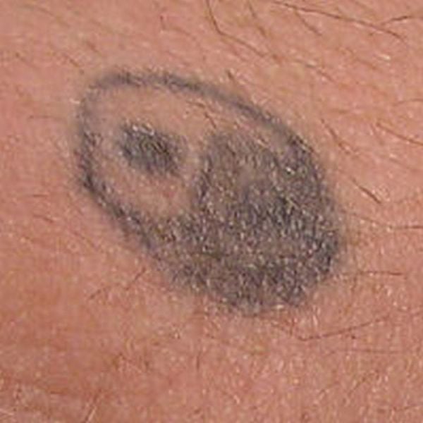 Horrible Self-made Tattoos