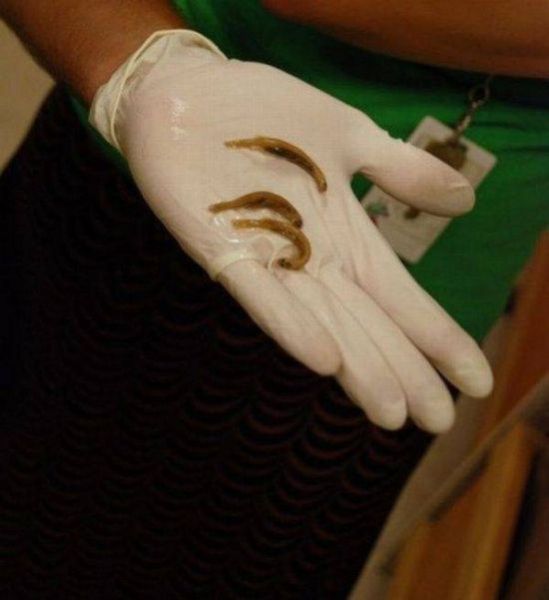 Little Fish that Can Climb Your Urethra