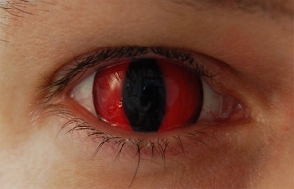 Eerie Eyeball Covers