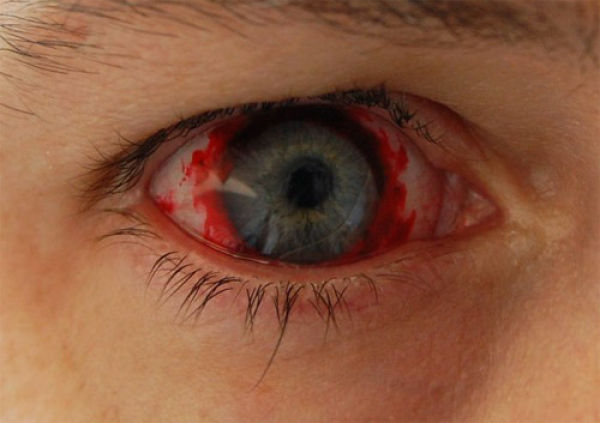 Eerie Eyeball Covers