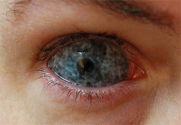 Eerie Eyeball Covers