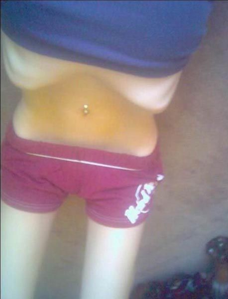 Anorexic Girls