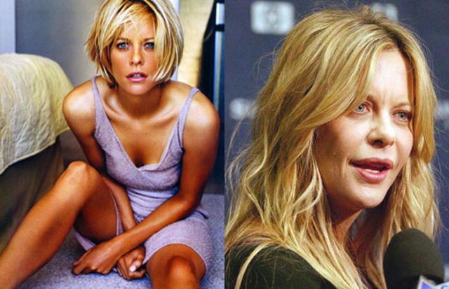 From Hottie to Ugly: Female Celebtrites Who Were Hot