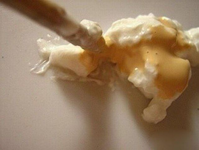 Are These Horrible Hand Wounds Real?