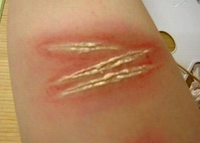 Are These Horrible Hand Wounds Real?