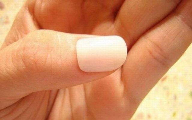 Are These Horrible Hand Wounds Real?