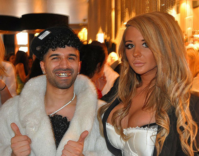 Swedish Blonde Had a Dozen Plastic Surgeries