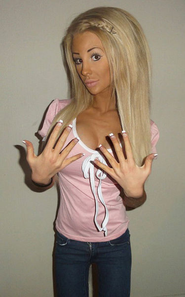 Swedish Blonde Had a Dozen Plastic Surgeries