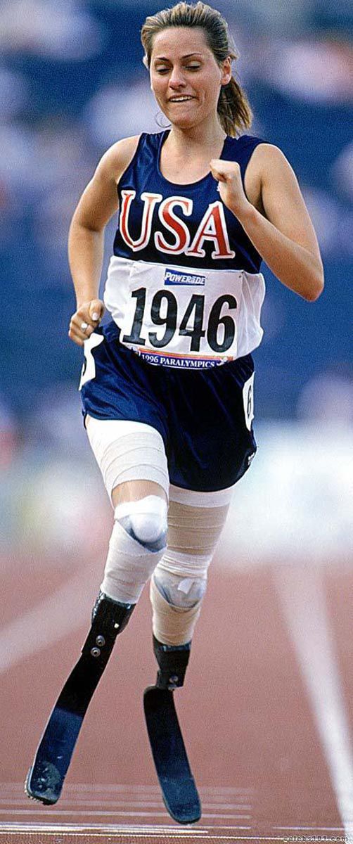 Woman Overcomes Huge Adversity