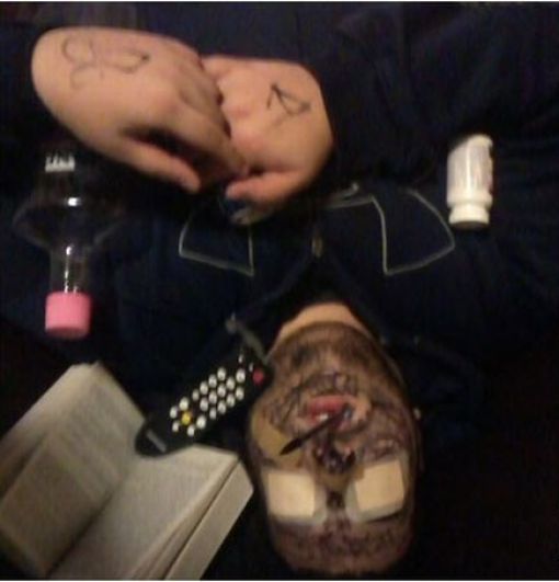 I Blacked Out, I Think…