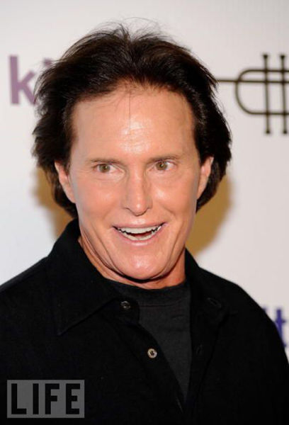 Celebrity Plastic Surgery Before & After